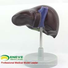 VISCERA08 (12545) Modelo anatómico humano de hígado de tamaño natural humano